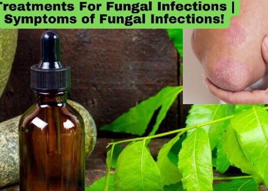 Treatments For Fungal Infections | Symptoms of Fungal Infections